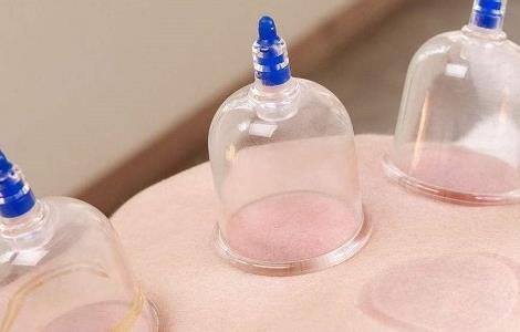 拔火罐的好处和坏处-农百科